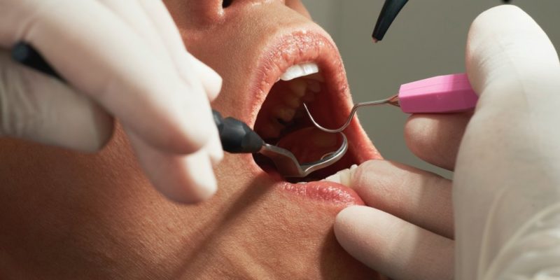 Tandläkare Järfälla löser dina tandbekymmer